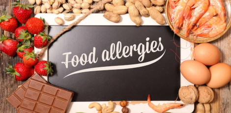 Be careful!! Watch out for these important signs of food allergy!!