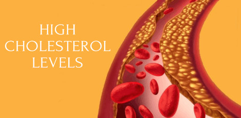 Be careful about these signs of high cholesterol that will be seen in the legs!!