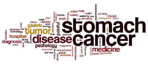 Stomach cancer can occur in us due to these habits, please be careful and take care!!