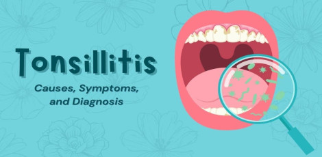 Tonsillitis – Various important things to know!!