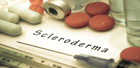 Scleroderma, an autoimmune issue – Important things to know!!