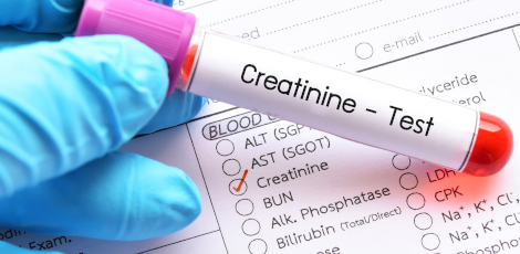 Creatinine-Test-060824
