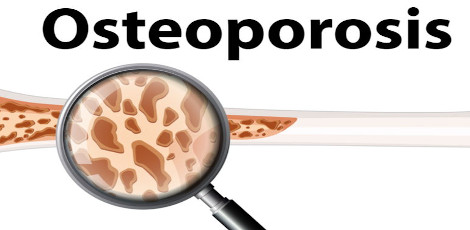 Impact of diabetes on our bone health – Various important things to know!!