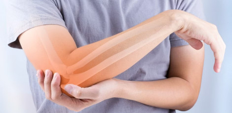 Unbelievable!! Fractures can be fixed in just 3 minutes with the help of this latest Bone Glue!!