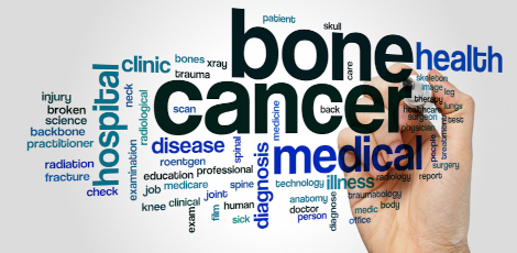 Important things that we must know about bone cancer!!