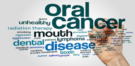 Warning signs of oral cancer that we all must know!!