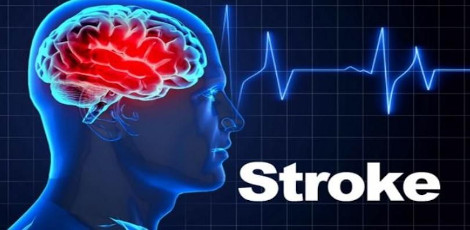 Why these days many young & middle aged adults get strokes more than others?