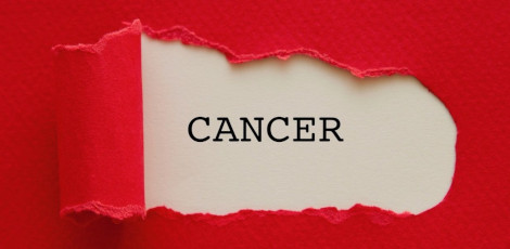 Be careful!! Various pre-cancerous signs that could reveal the presence of cancerous growth!!
