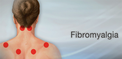 These signs would reveal that the person has got a fibromyalgia issue!! These signs would reveal that the person has got a fibromyalgia issue!!