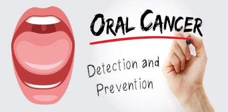 Know about these important signs of oral cancer and get treated immediately!!