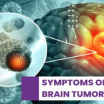 Brain tumour is revealed by these early signs, take care!!