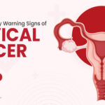 Every woman must know about these important signs of cervical cancer?