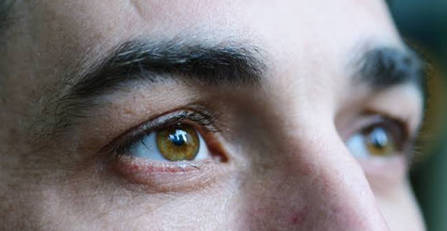 Are you aware of these symptoms, risk factors, treatments for TED or thyroid eye disease?