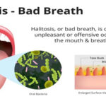 Having Halitosis or Bad breath problem? - These can be the important reasons!!