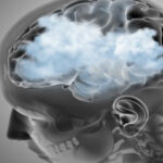 Brain Fog - Its causes, treatments, foods to eat etc!!