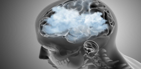 Brain Fog - Its causes, treatments, foods to eat etc!!