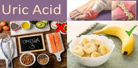 Dont eat these foods if your uric acid level is high!!