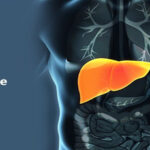 Having liver damage, then your feet might show these signs, take care!!