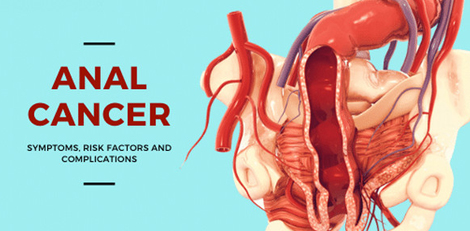 Be careful about these symptoms of anal cancer!! Be careful about these symptoms of anal cancer!!