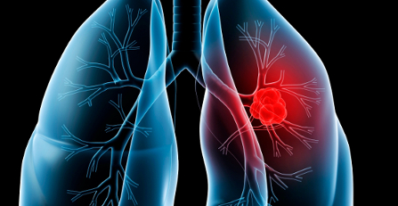 These signs would reveal the presence of lung diseases in us, take care!! These signs would reveal the presence of lung diseases in us, take care!!
