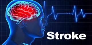 Precautions That May Help Reduce Stroke Risk