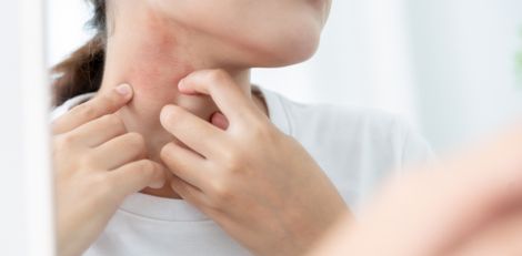Heat Rash: What Is It and How to Get Quick Relief?